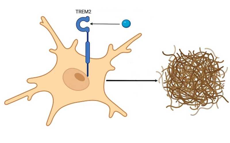 Опухоли ослабляют амилоидную патологию при болезни Альцгеймера