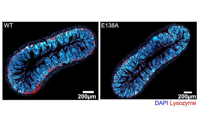 Мутация, связанная с псориазом, нарушает моторику кишечника