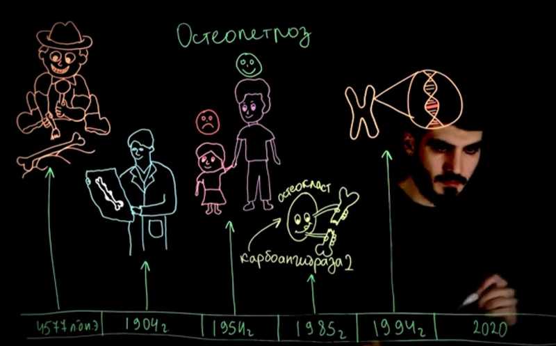 Остеопетроз