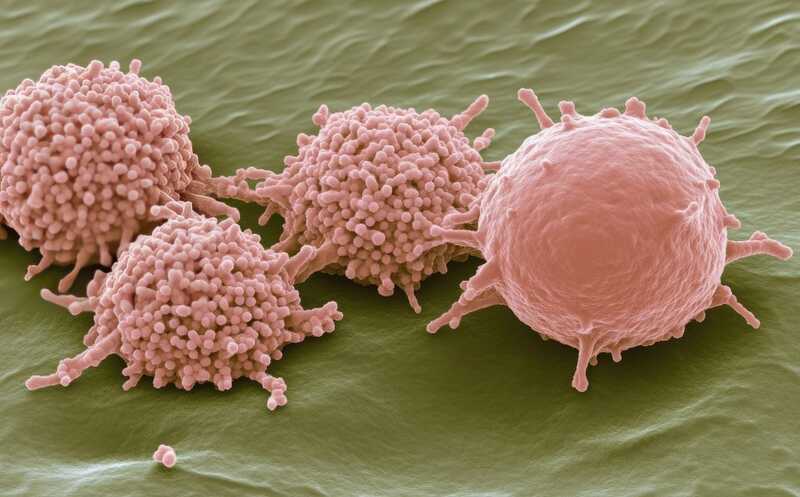 Раковые клетки становятся мягкими и ускользают от иммунного ответа