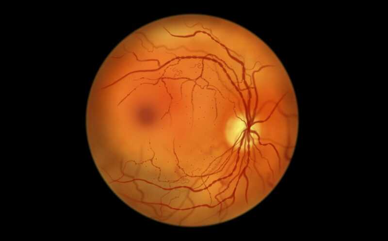 Сосуды сетчатки как индикатор старения организма