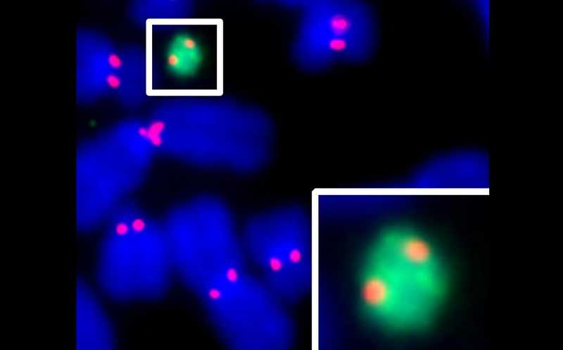 Предложена новая методика для создания искусственных хромосом человека
