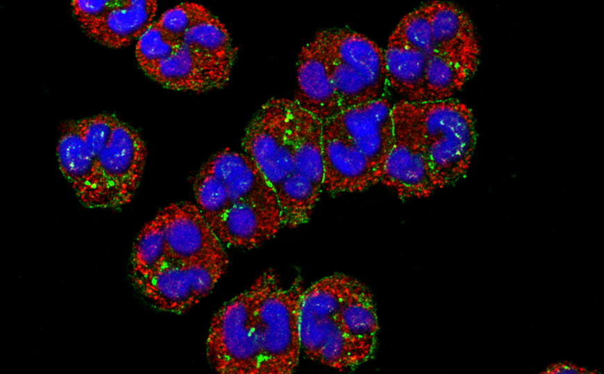 Какие иммунные клетки спасают голодную мышь от инфекций?