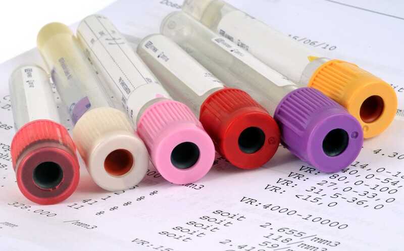 Исход серьезной травмы можно предсказать с помощью мультиомиксного анализа крови