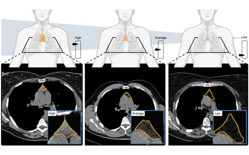 Роль тимуса во взрослом организме была недооценена