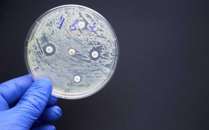 Оптимизация потребления антибиотиков может уменьшить распространенность резистентных патогенов на 15–20% за десять лет