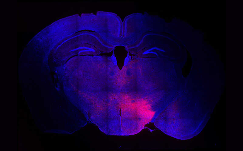 Острый стресс ослабляет разные формы зуда у мышей