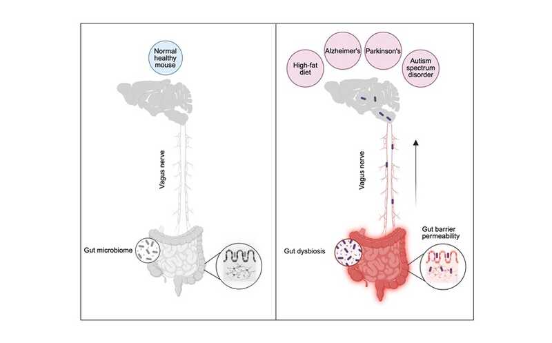 Бактерии из кишечника проникают в мозг мыши на высокожировой диете