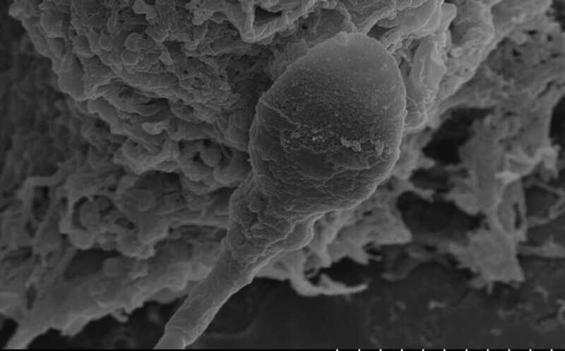 Микрогравитация сбивает сперматозоид с пути