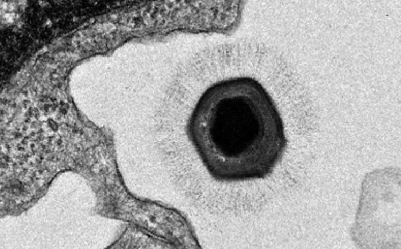 Гигантские вирусы приходят в клетку амебы со своими факторами инициации трансляции