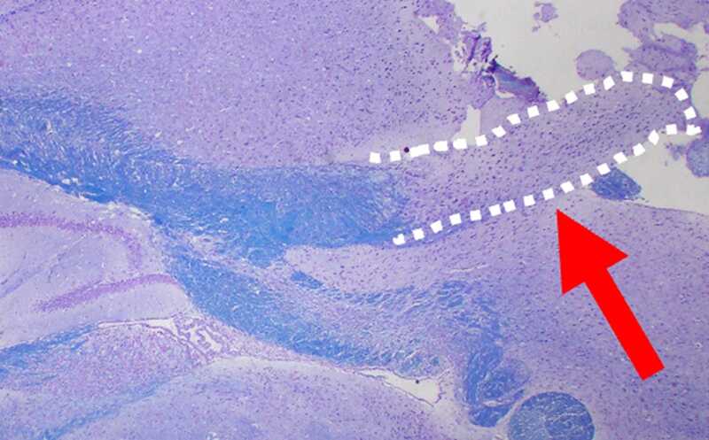 Сенолитики дазатиниб и кверцетин нарушают формирование миелиновой оболочки в мозге мыши