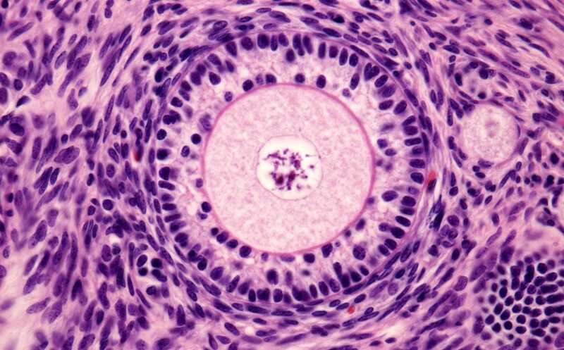 Препарат, назначаемый при болезни почек, восстанавливает функцию яичников