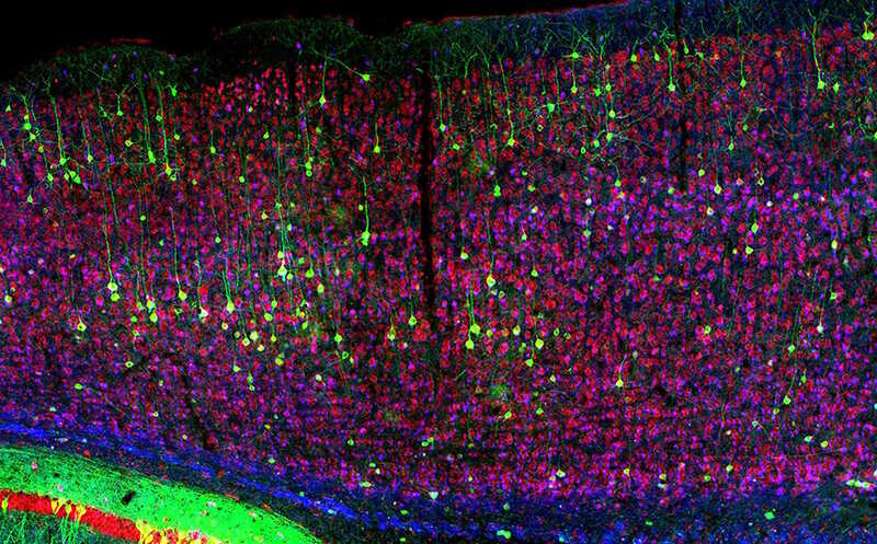 Полимерный электрод синтезировался в мозге живой мыши