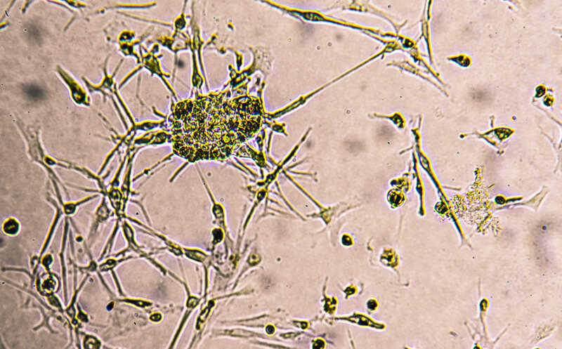 Контрольная точка иммунитета играет неиммунную роль в клетках глиобластомы