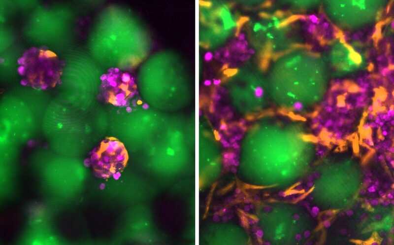 Трансплантат из смеси гепатоцитов с гелевыми микросферами может помочь при печеночной недостаточности