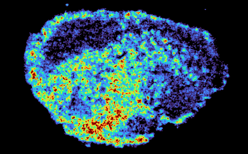 Чувствительность раковых клеток к ингибиторам PARP зависит от работы лизосом