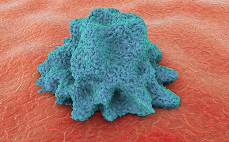 Макрофаги детектируют рану и повышают проницаемость сосудов рядом с ней