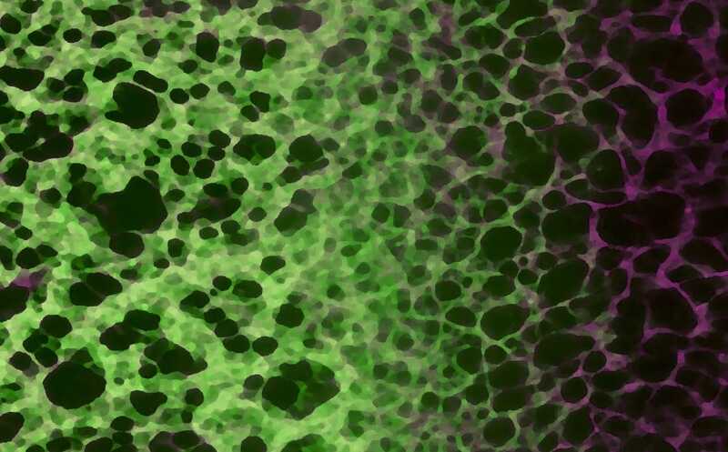 Клетки стареющих животных теряют эндоплазматический ретикулум