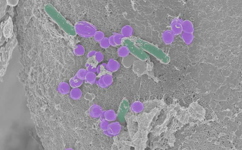 Дисбиоз кишечника основан на длительном подавлении конкурентов