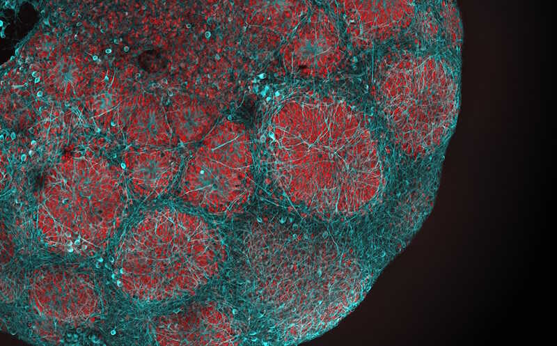 Силденафил смягчил симптомы митохондриальной болезни у детей