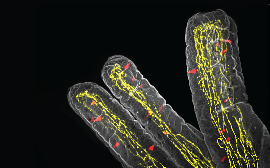Иммунная система подавляет аппетит при заражении паразитами
