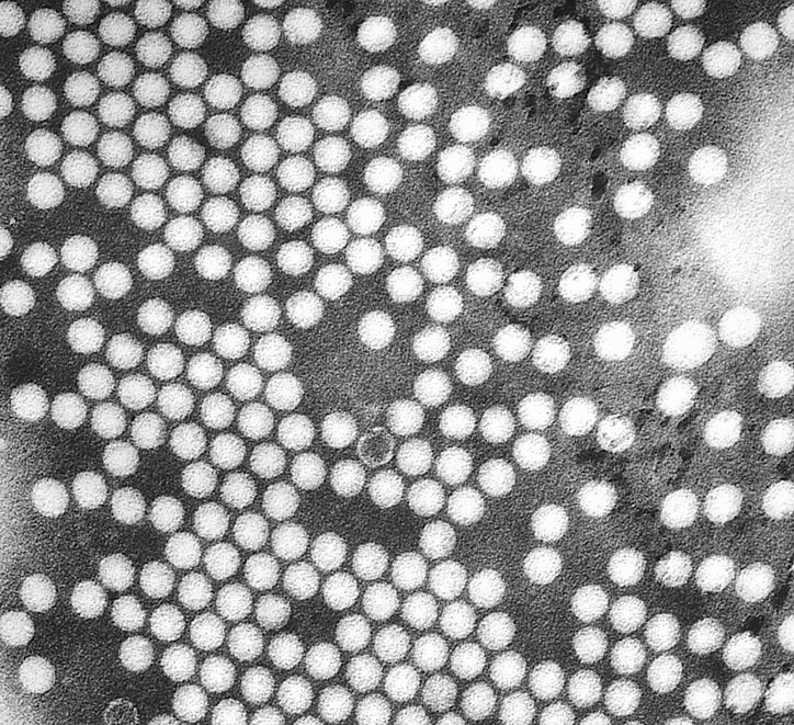 вирус полиомиелита.png